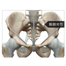 骶髂关节紊乱